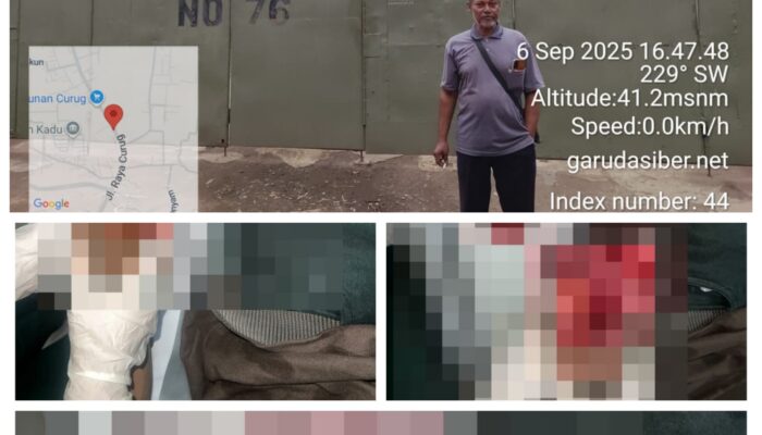Sadis ! PT Tri Excella Harmony Diduga Masa Bodo Kepada Karyawannya yang Kecelakaan Kerja Sampai Cacat Permanen