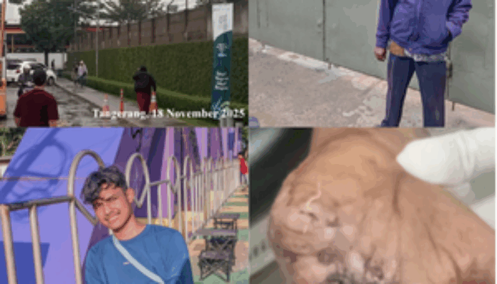 PT Tri Excella Harmony Diduga Mempermainkan Karyawan Korban Kecelakaan Kerja