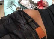 Ingin Menggagalkan 4 Maling Dijatake, Warga Jadi Korban Penusukan.
