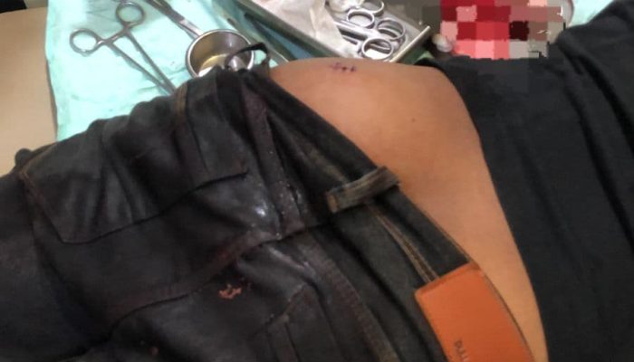 Ingin Menggagalkan 4 Maling Dijatake, Warga Jadi Korban Penusukan.